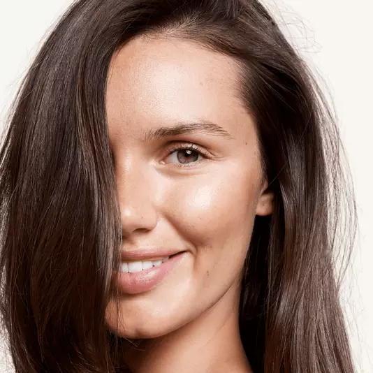 Hair transplant for women
