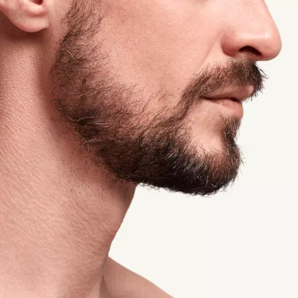 Beard hair transplant