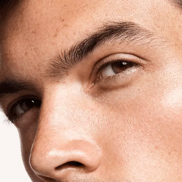 The eyebrow transplant